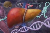 The image depicts an afflicted liver with mutated DNA and toxic RNA, and its predisposition for fatty liver disease and drug metabolism defects.