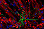 A colored microscope image depicting a green nerve surrounded by red and blue muscle cells.