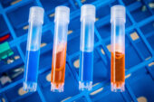 Smaller test tubes for COVID-19 testing at the University of Illinois Urbana-Champaign.