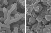 At normal tissue pH (left), the polymer does not kill bacteria. But in an acidic environment (right), it disrupts the H. pylori bacteria’s membranes to kill it.