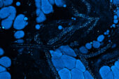 A constellation of vesicles, tiny cellular transport packages seen here as blue dots, are released by cancer cells into the surrounding tissue. Illinois researchers found that these vesicles, coupled with molecular changes in metabolism, can signal big changes in the tissue around tumors.