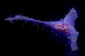 Researchers found that a class of molecules called sphingolipids congregate in large patches in the cell membrane. Red and yellow colors indicate local elevations in the sphingolipid abundance.