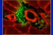 Mesenchymal stem cells (green) accumulate in skeletal muscle following exercise and release growth factors to spur regeneration.