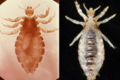 The head louse, left, and body louse, right, differ in habits, habitat and in their ability to transmit disease, but a new genetic analysis indicates they are likely the same species.