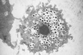 Giant viruses should be included reconstructions of the tree of life, researchers report in a new study. The mimivirus, shown here (small black hexagons) infecting an amoeba, is as big as some bacterial cells and shares some ancient protein structures with most organisms.