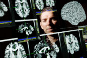 University of Illinois neuroscience professor Aron Barbey led a study that mapped the brain regions associated with emotional intelligence.