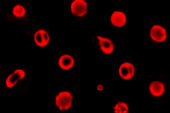 A research team led by electrical and computer engineering professor Gabriel Popescu used a novel measurement technique called diffraction phase microscopy to reveal the mechanics of red blood cells.