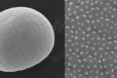 A team of researchers at the University of Illinois used scanning electron microscopy to produce detailed images of whole pollen grains like that of the Poa australis species shown here, left. A computer program then used the high-resolution grain surface patterns, right, to classify and identify the species of grass pollen.