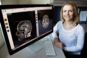 University of Illinois Beckman Institute postdoctoral researcher Agnieszka Burzynska and her colleagues found that physical activity and sedentary behavior are each associated with specific differences in brain white matter integrity.