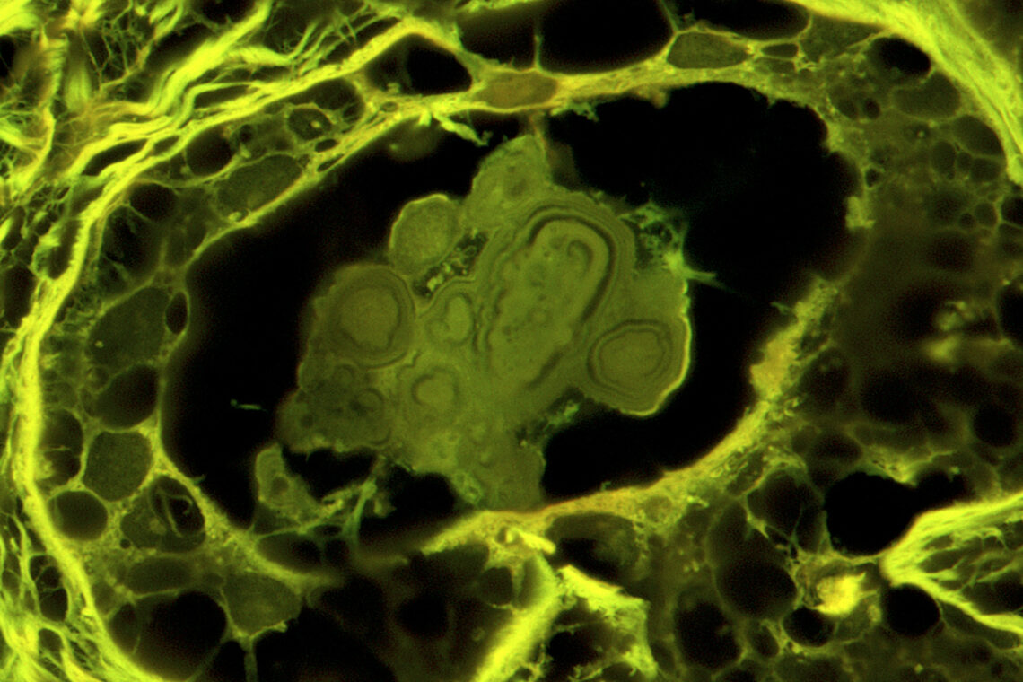 A yellow tissue image