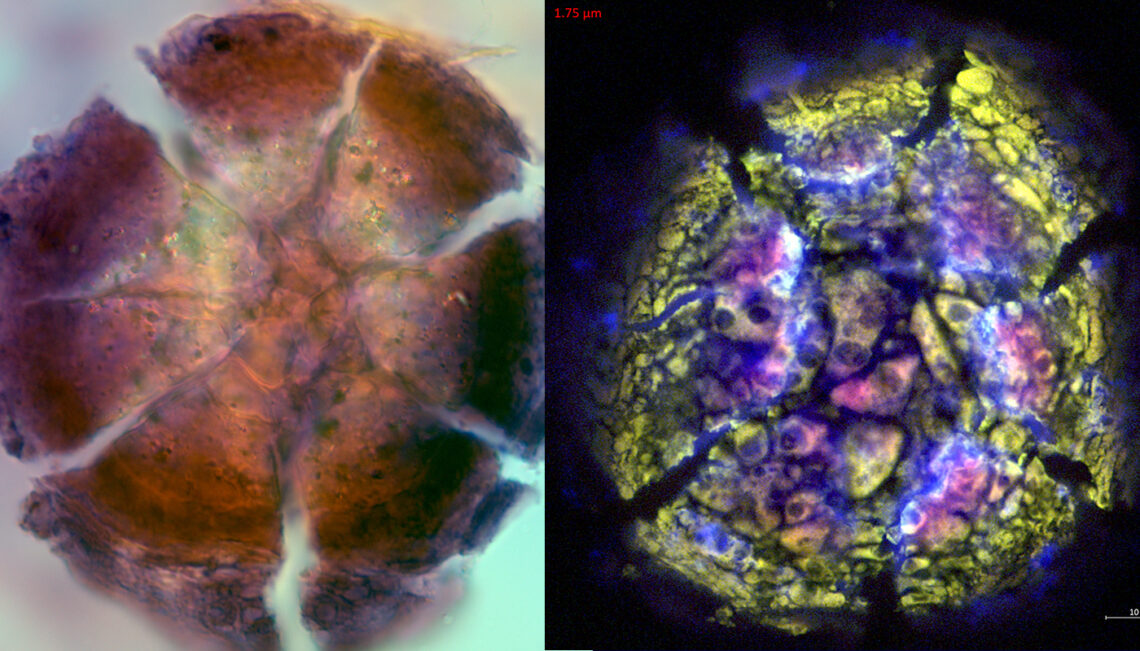 Two side by side microscope images of the same tissue sample images with different techniques