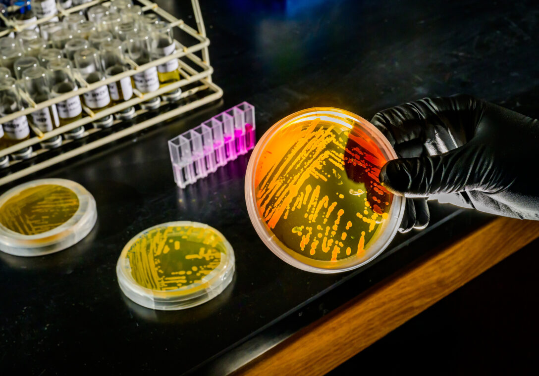 In his lab, microbiology Professor Wei Qin shows off a culture tray and a colorimetric assay that highlights the microbes’ metabolic activity. Qin’s work focuses on an abundant microbial group that populates the deep ocean where warming and iron limitation have a major impact on ocean circulation and climate change. Photo taken at the University of Illinois Urbana-Champaign on Wednesday, Feb. 11, 2026. (Photo by Fred Zwicky / University of Illinois Urbana-Champaign)