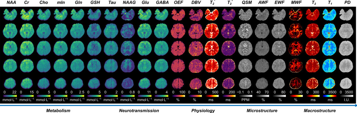 A spectrum of MRI scans
