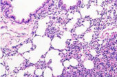 A microscope image of tissue