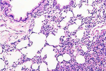 A microscope image of tissue