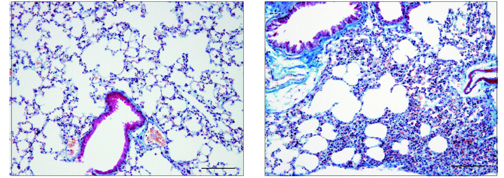 Two side by side microscope images