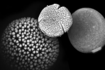 Micrograph of three very different-looking pollen grains.